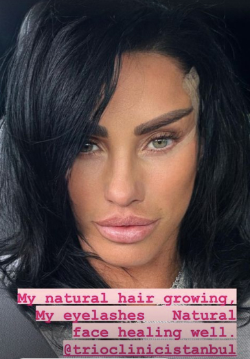 Katie Price showed off her new face after her facelift