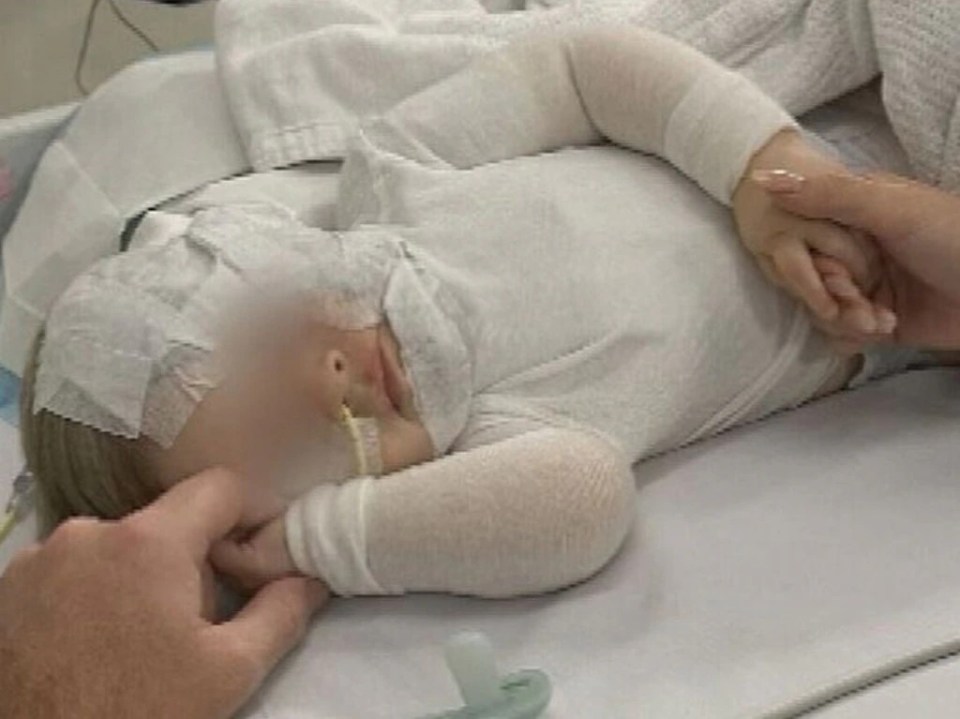 The baby has been left with 60 per cent burns after stranger doused him with scalding hot coffee