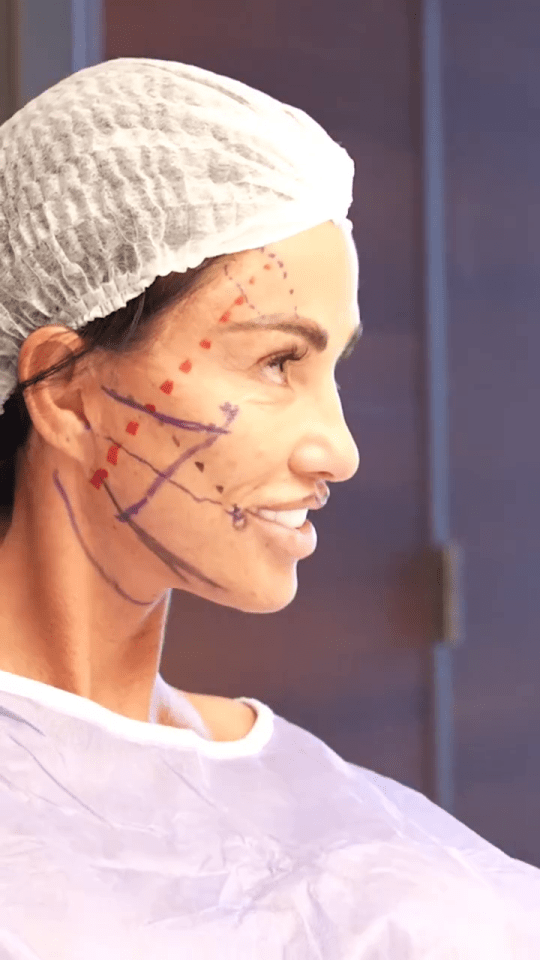 a woman wearing a surgical cap has lines drawn on her face