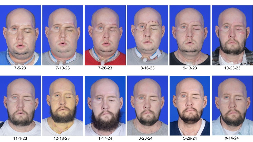 a bald man with a beard is shown in a series of photos