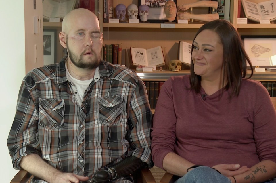 a man with a prosthetic arm sits next to a woman