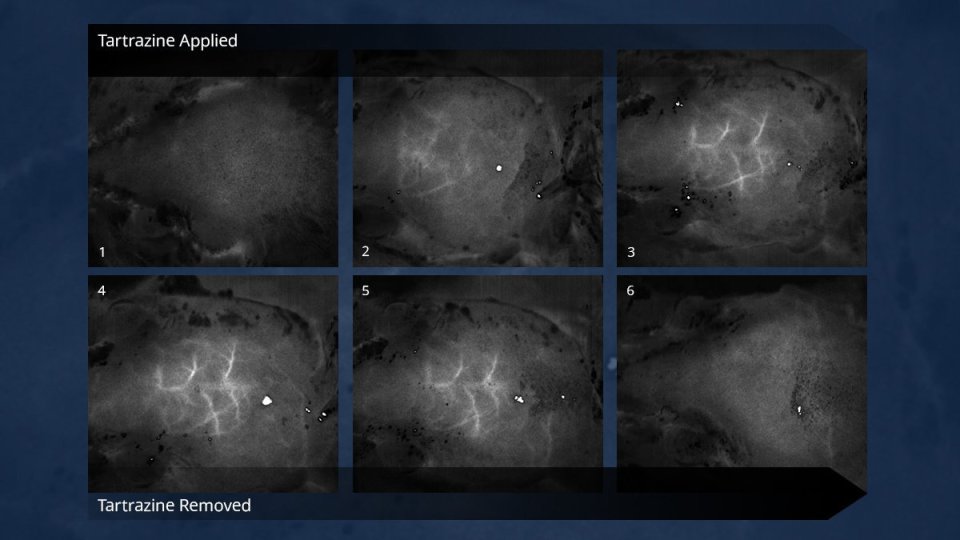 Timelapse images of blood vessels in the brain, just beneath the skull of a mouse