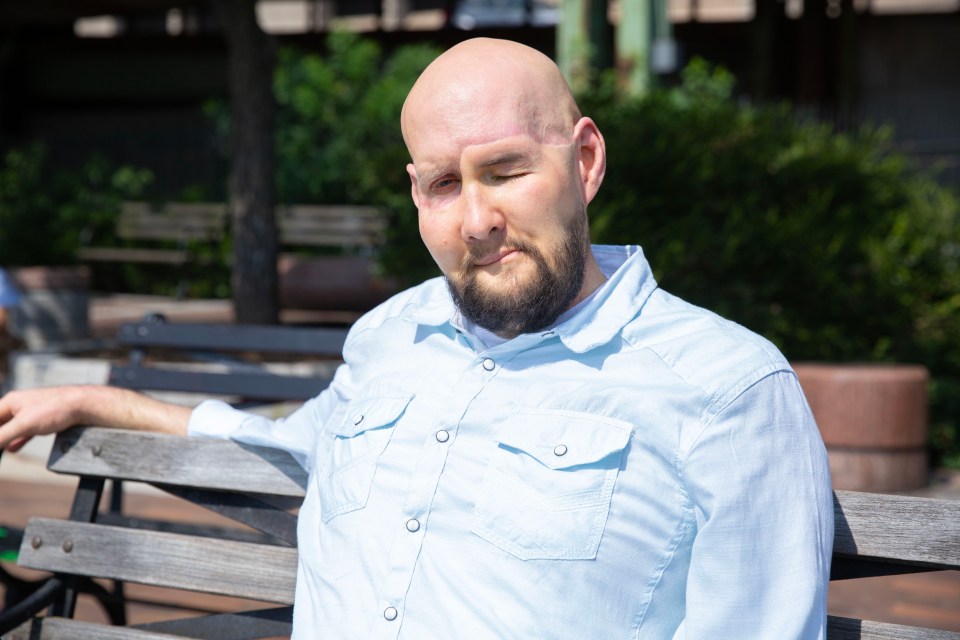 a bald man with a beard sits on a park bench with his eyes closed