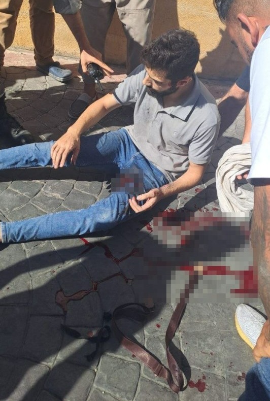 A man pictured covered in blood after a pager in his pocket exploded