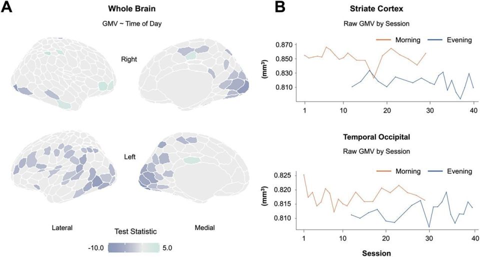 The study involved scanning the brain of a 26-year-old man 40 times over 30 days