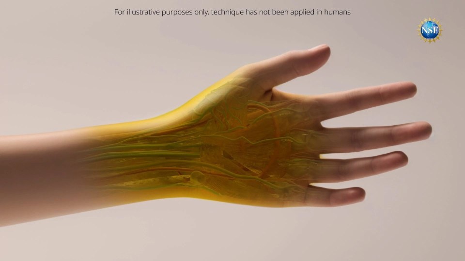 a picture of a hand with the words for illustrative purposes only technique has not been applied in humans