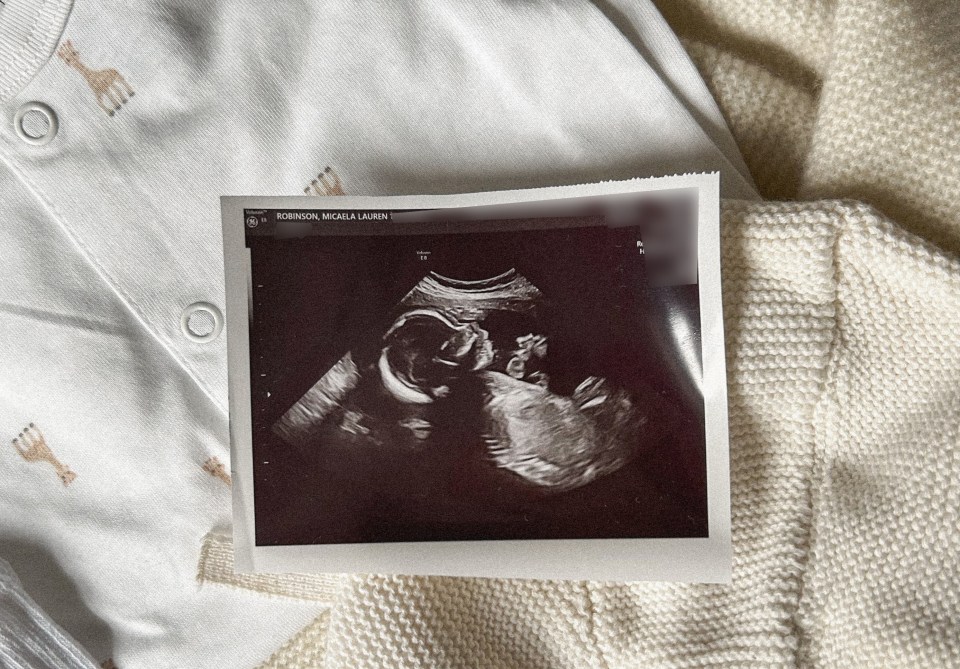 Micaela posted her ultrasound scan in March after learning the gender of her baby