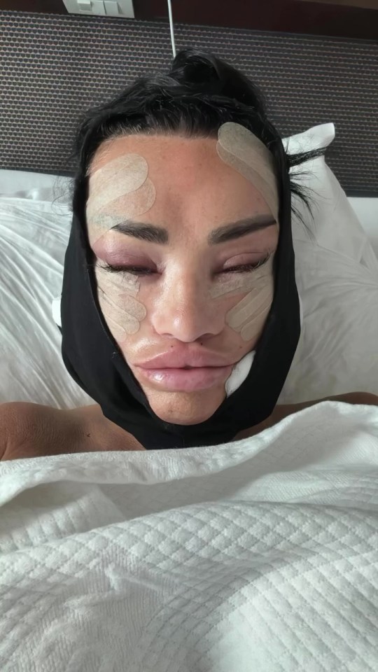 a woman with bandages on her face is laying in bed