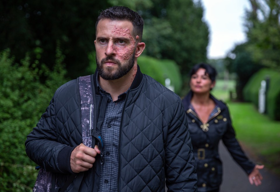 Michael Parr is preparing for a huge comeback on Emmerdale as Ross Barton