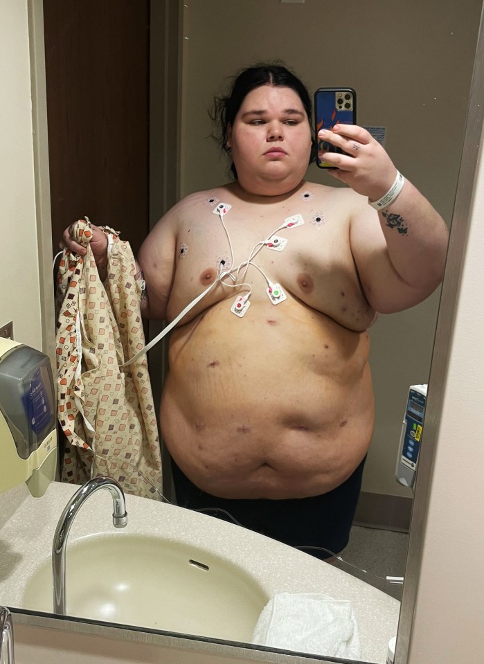 He weighed 427lbs and underwent bariatric surgery