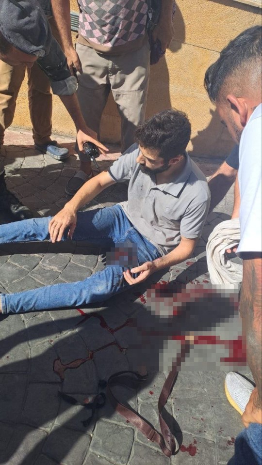 A man pictured covered in blood after a pager in his pocket exploded