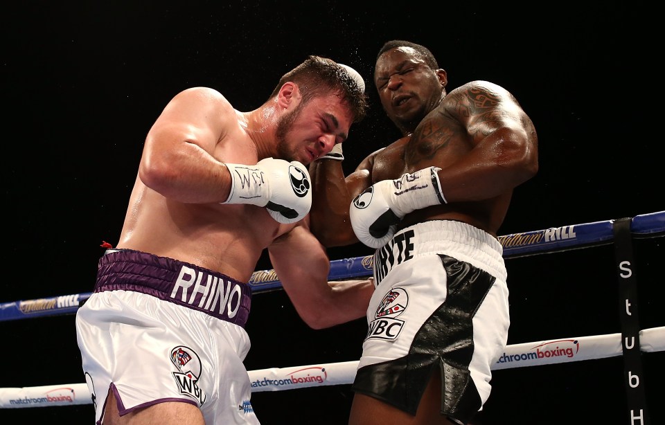 Allen lost to former sparring partner Dillian Whyte in 2016