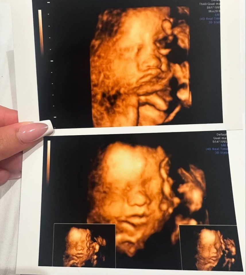 two ultrasound images of a baby 's face are being held by a woman