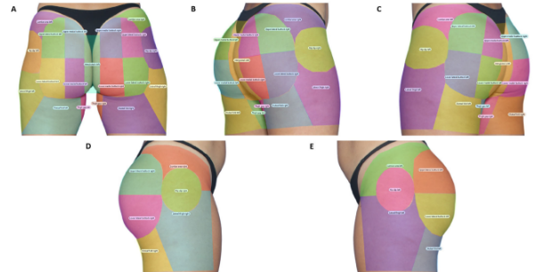 Bottoms were mapped and eyes were tracked to see where people held their gaze the longest (Credit: Aesthetic Plastic Surgery journal)