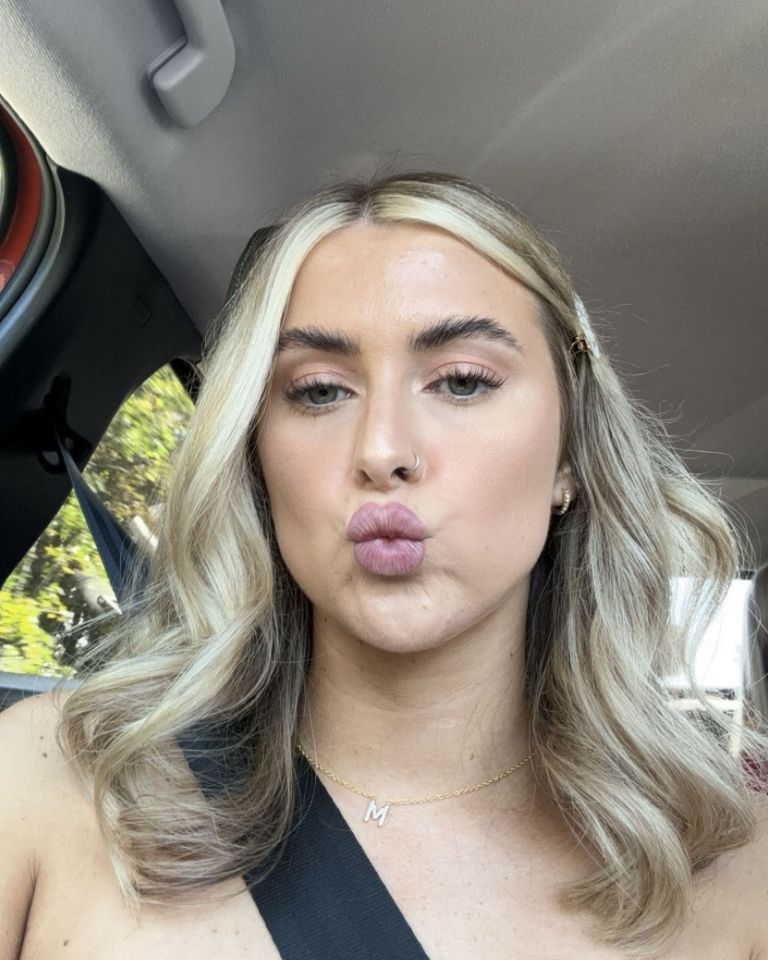 Melia Nielsen, 24, opted for microneedling to feel ‘confident’ without makeup