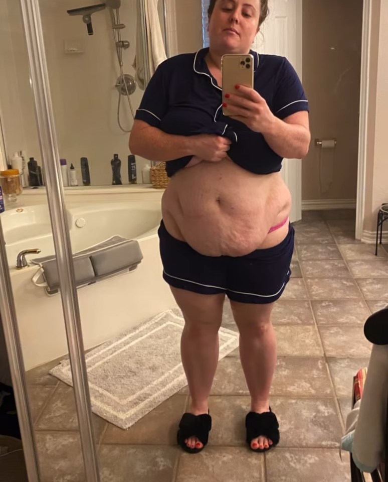 Erin decided to lose weight after her calf burst beneath her