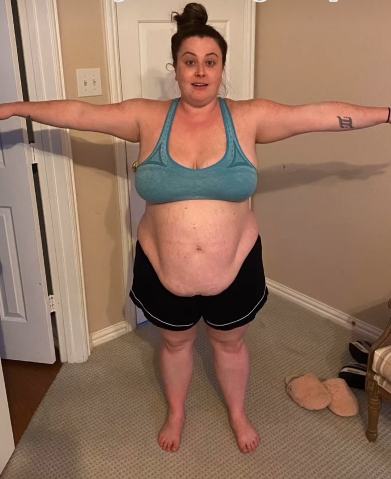 At her largest, Erin weighed 22 stone