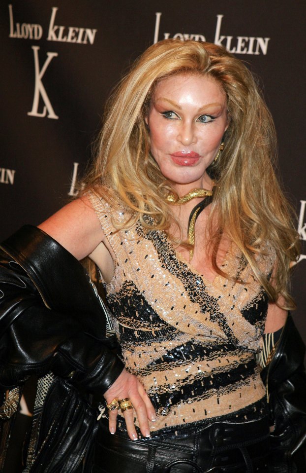 Wildenstein has denied having plastic surgery to look more like a cat