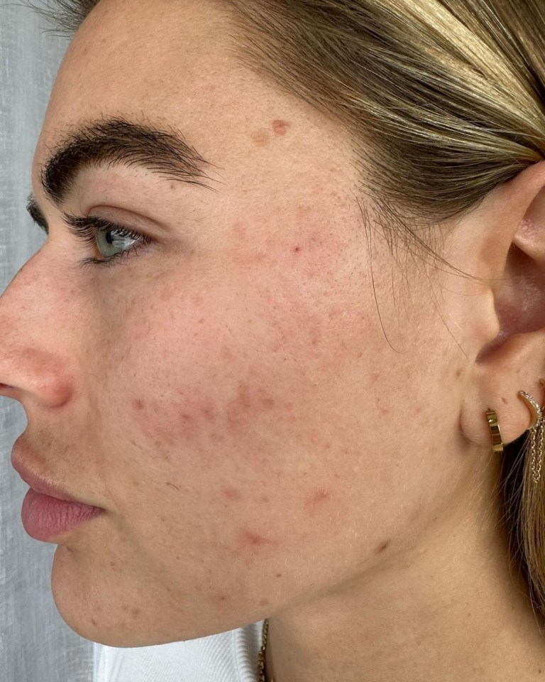 a close up of a woman 's face with earrings