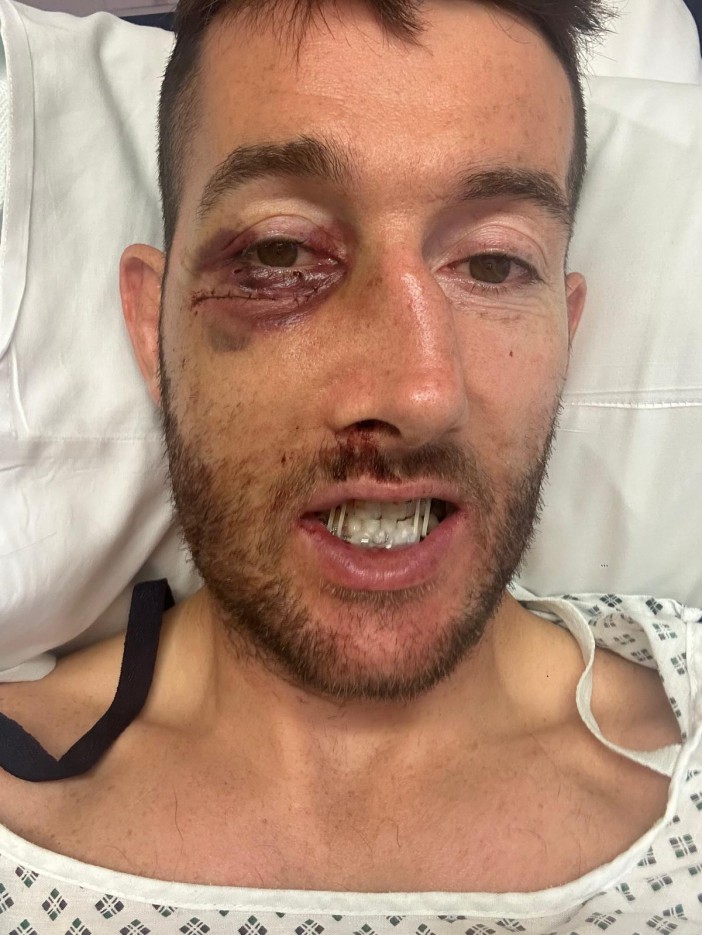 Stefan Ratchford picked up 11 facial fractures after being caught with an elbow in Warrington Wolves' win over St Helens in July