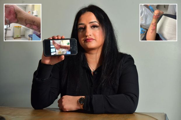 a woman is holding up a cell phone with a picture of her arm on it