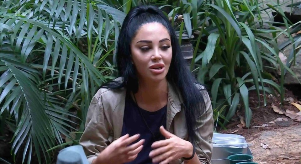 I'm A Celeb's Tulisa has had cosmetic surgery after being diagnosed with Bell’s palsy