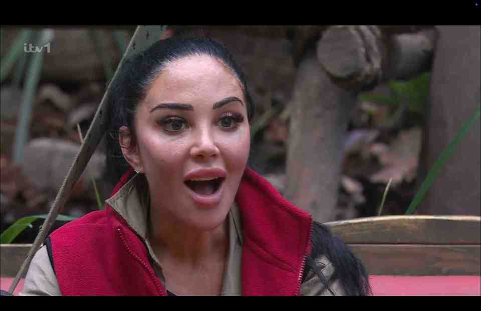 Tulisa opened up about Bell's palsy on I'm A Celeb