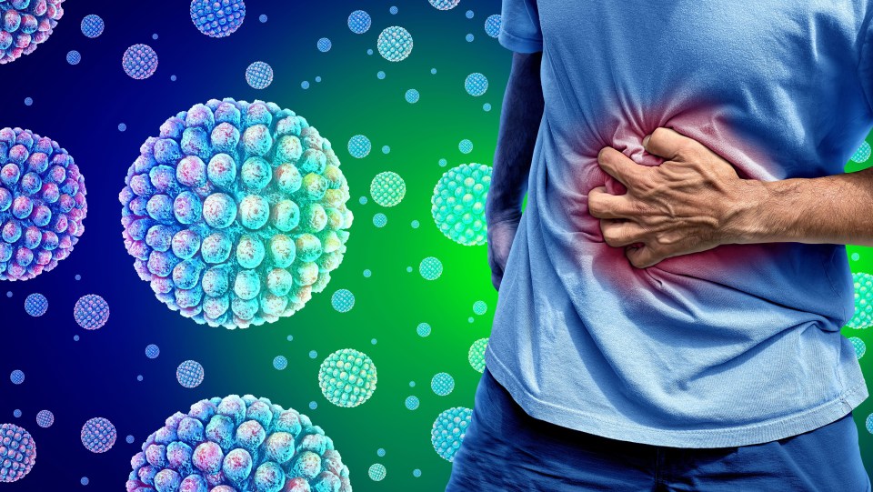 Norovirus can cause nausea, vomiting and diarrhoea