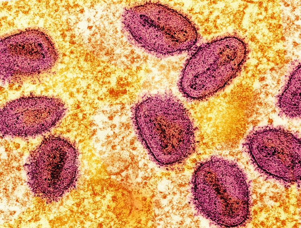 a close up of purple cells on a yellow background