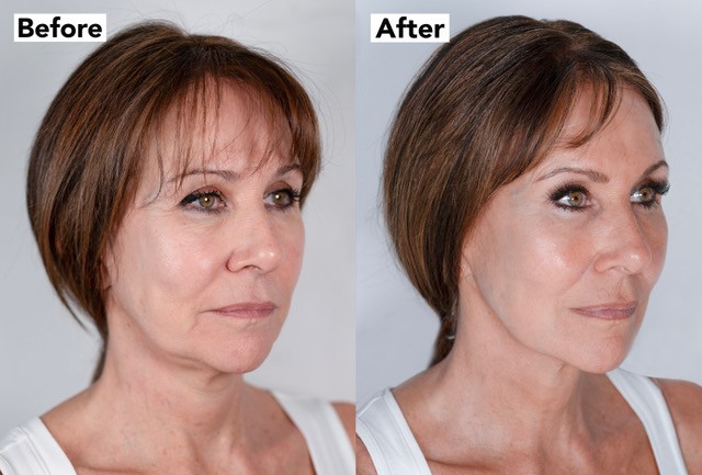 a before and after photo of a woman 's face