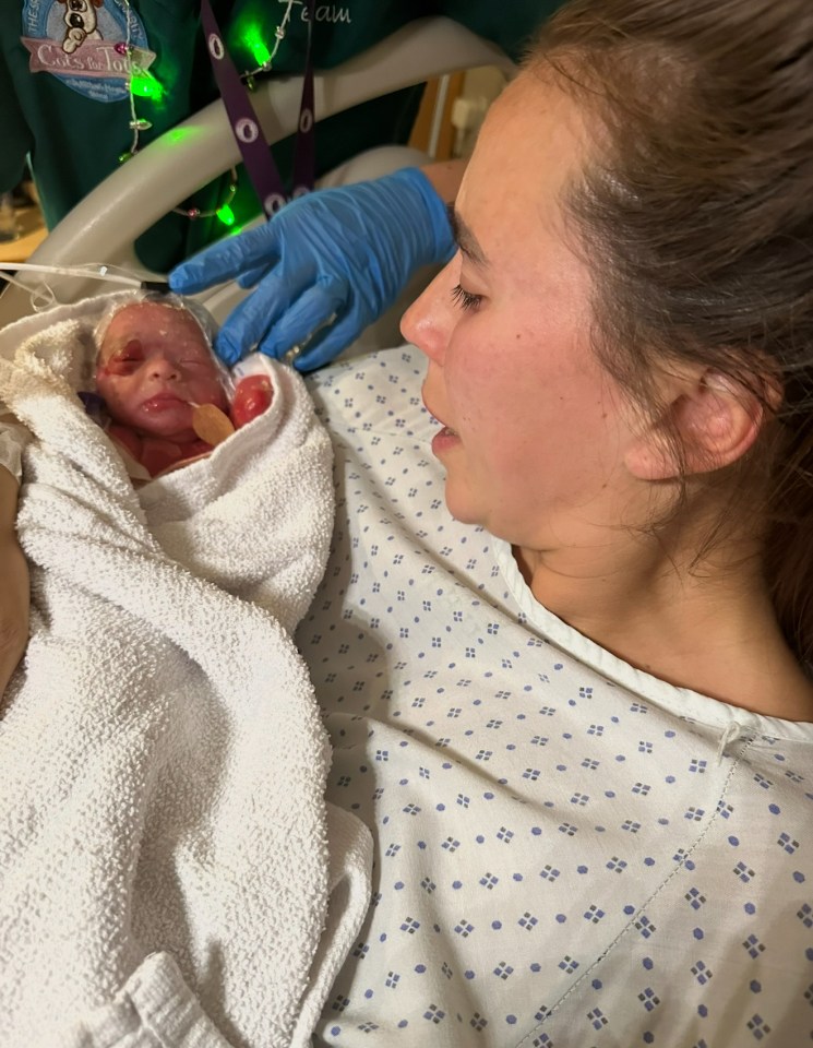 Luca weighed just two and a half pounds when he was born