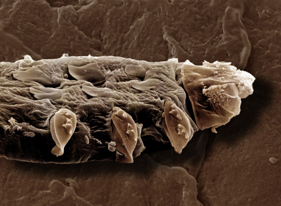 Demodex can cause skin problems in large numbers