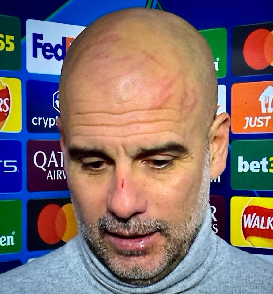 The scratches were clear as he admitted City's performance was 'hard to swallow'