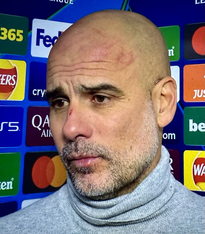 Pep Guardiola's scratched head