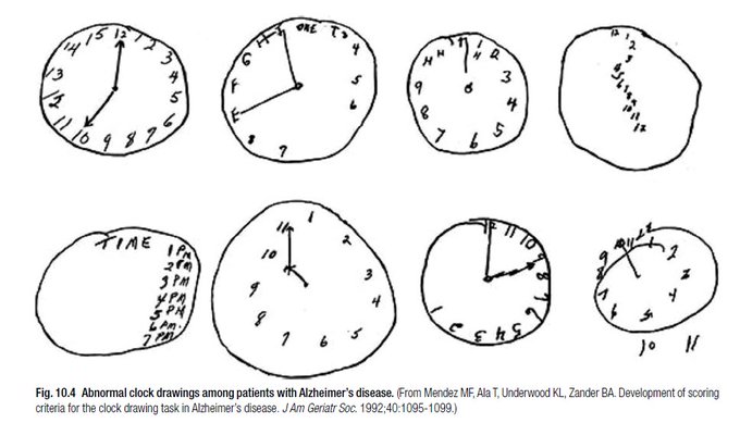 Trying to draw a clock from memory can be an effective way to gauge someone's risk of dementia