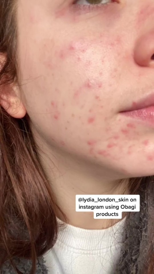 GK Barry took to TikTok to share a video showing how she transformed her skin