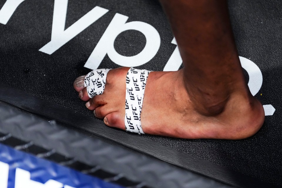 a person 's foot with ufc tape on it