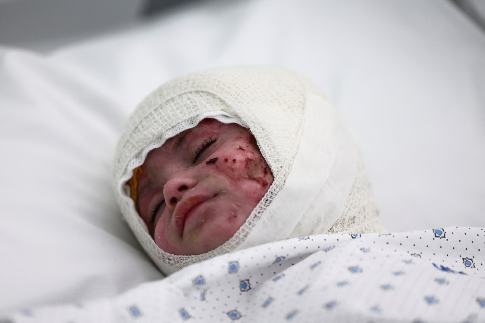 a child with a bandage on their head is laying in a hospital bed