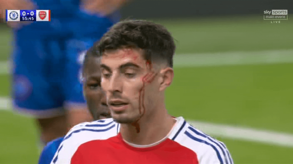 Kai Havertz was left covered in blood again