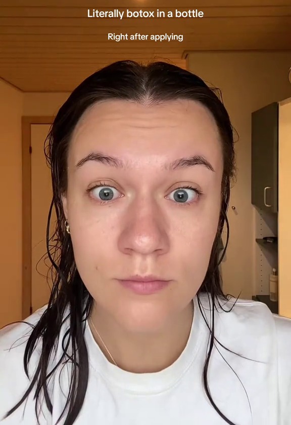 Martine showed the difference it made after applying the serum