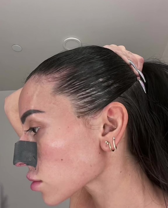 The beauty fan was devastated when her hair started to fall out and leave bald patches