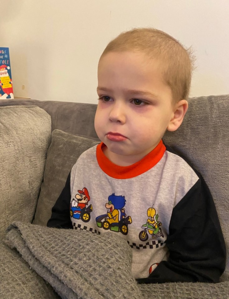 Theo was in pre-school when he became ill, at first struggling to recover from an ear infection