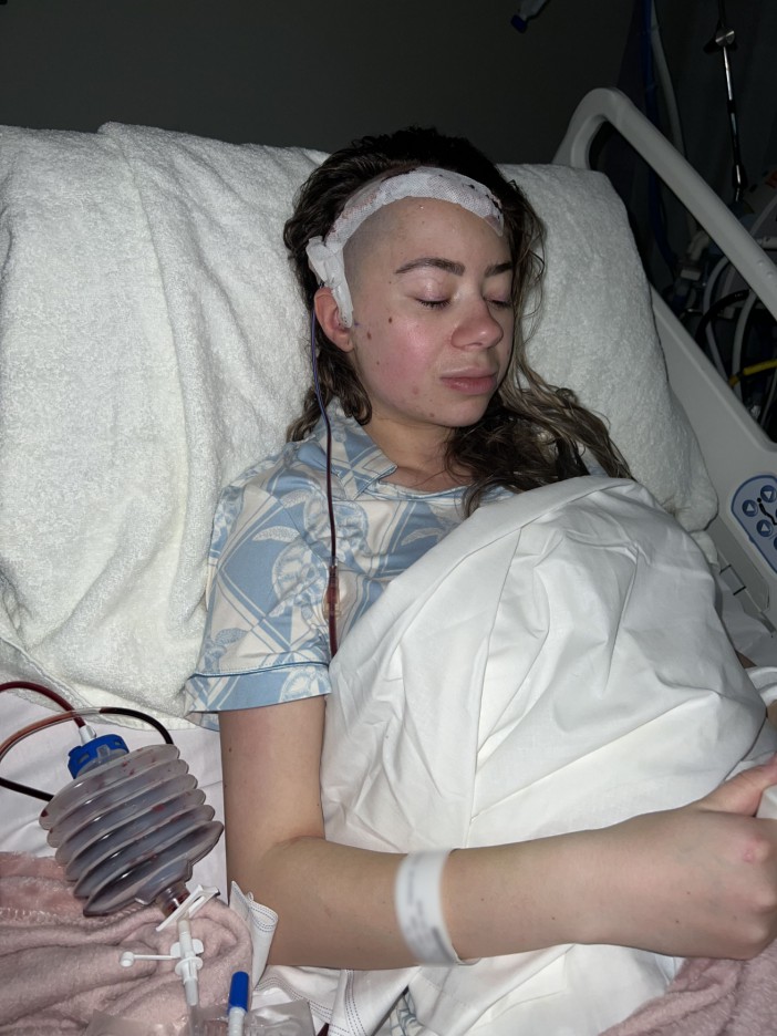 Pic from Kennedy News & Media (Pictured:TIA BRADBURY, 25, IN HOSPITAL. ) A mum claims her declining vision was dismissed by doctors as 'migraines' until she went BLIND - only to discover they were a hidden brain tumour. Tia Bradbury, from Crewe, had been experiencing migraines and eye 'flickering' for months but says doctors dismissed her symptoms as hemiplegic migraines in December last year - without doing any scans. The 25-year-old's vision in her left eyesight was getting worse by the day and she became convinced something more was going on when she noticed personality changes such as irritability. DISCLAIMER: While Kennedy News and Media uses its best endeavours to establish the copyright and authenticity of all pictures supplied, it accepts no liability for any damage, loss or legal action caused by the use of images supplied and the publication of images is solely at your discretion. SEE KENNEDY NEWS COPY - 0161 697 4266