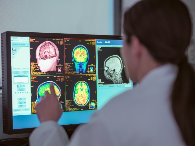 Doctor reviewing brain scans on a computer monitor.