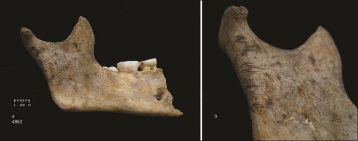 Experts believe the plague, found in the teeth of two remains, could have inflamed tensions between two clans