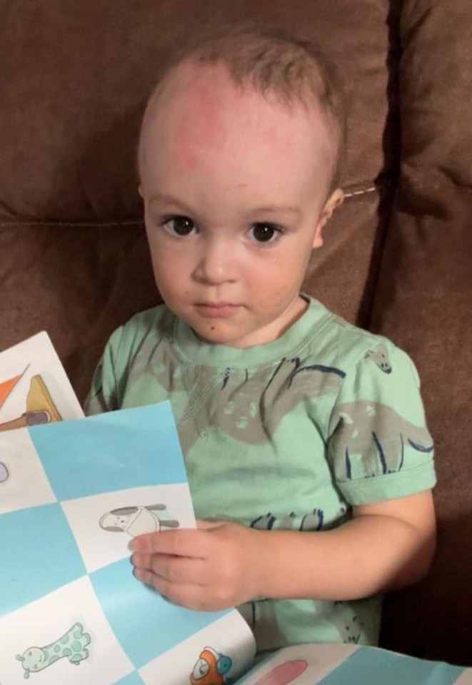 The tot also suffered a dog bite on his ear when the accident happened