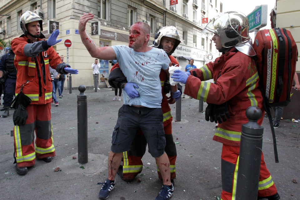 A bloodied English soccer fan is aided by rescue workers after a street brawl.