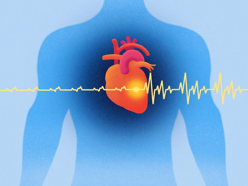 Heart problem symptoms can be subtle, and easily mistaken for other conditions