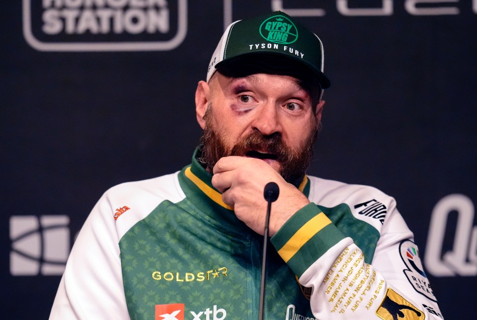 Tyson Fury is open to any challenge 2025 brings