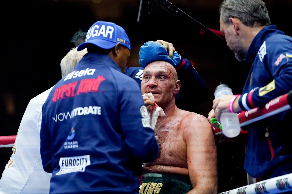 Tyson Fury, injured and bleeding, receives medical attention in the ring.